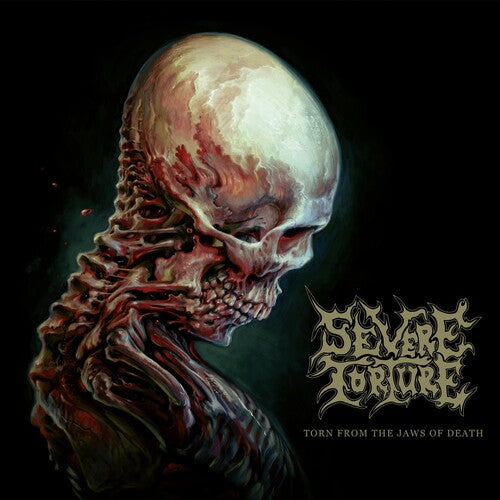 Severe Torture - Severe Torture - Torn From The Jaws Of Death